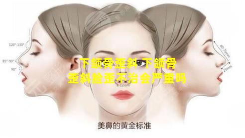 下颌骨歪斜 下颌骨歪斜脸歪不治会严重吗
